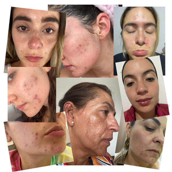 Serum Aclarante Valerisse