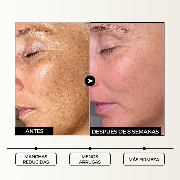 Serum Aclarante Valerisse