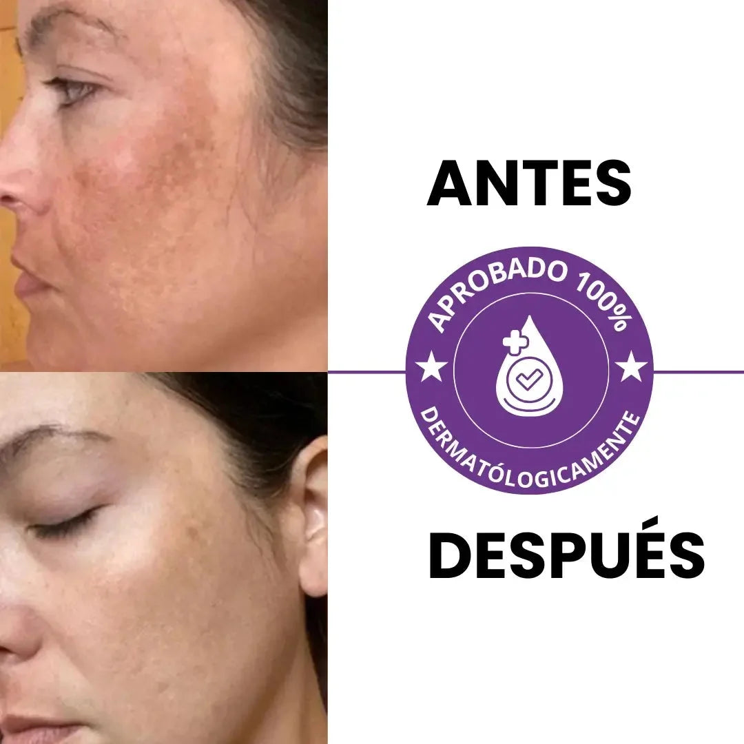 2X1 HOY Aclara Tu Piel Mientras Duermes En Solo Dos Semanas